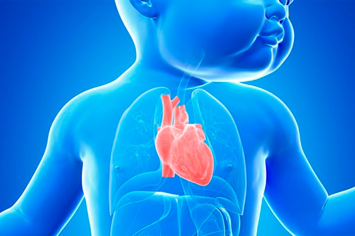 Cardiopatias congenitas