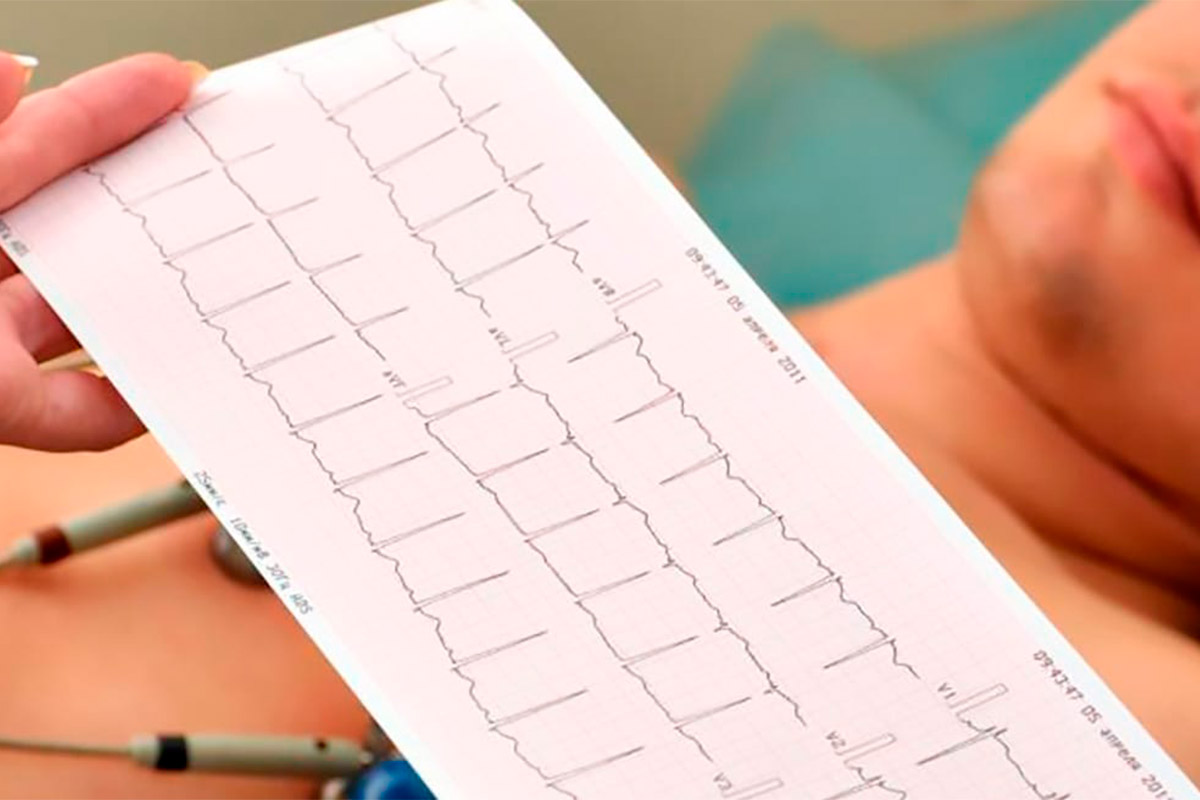 estudios cardiologicos